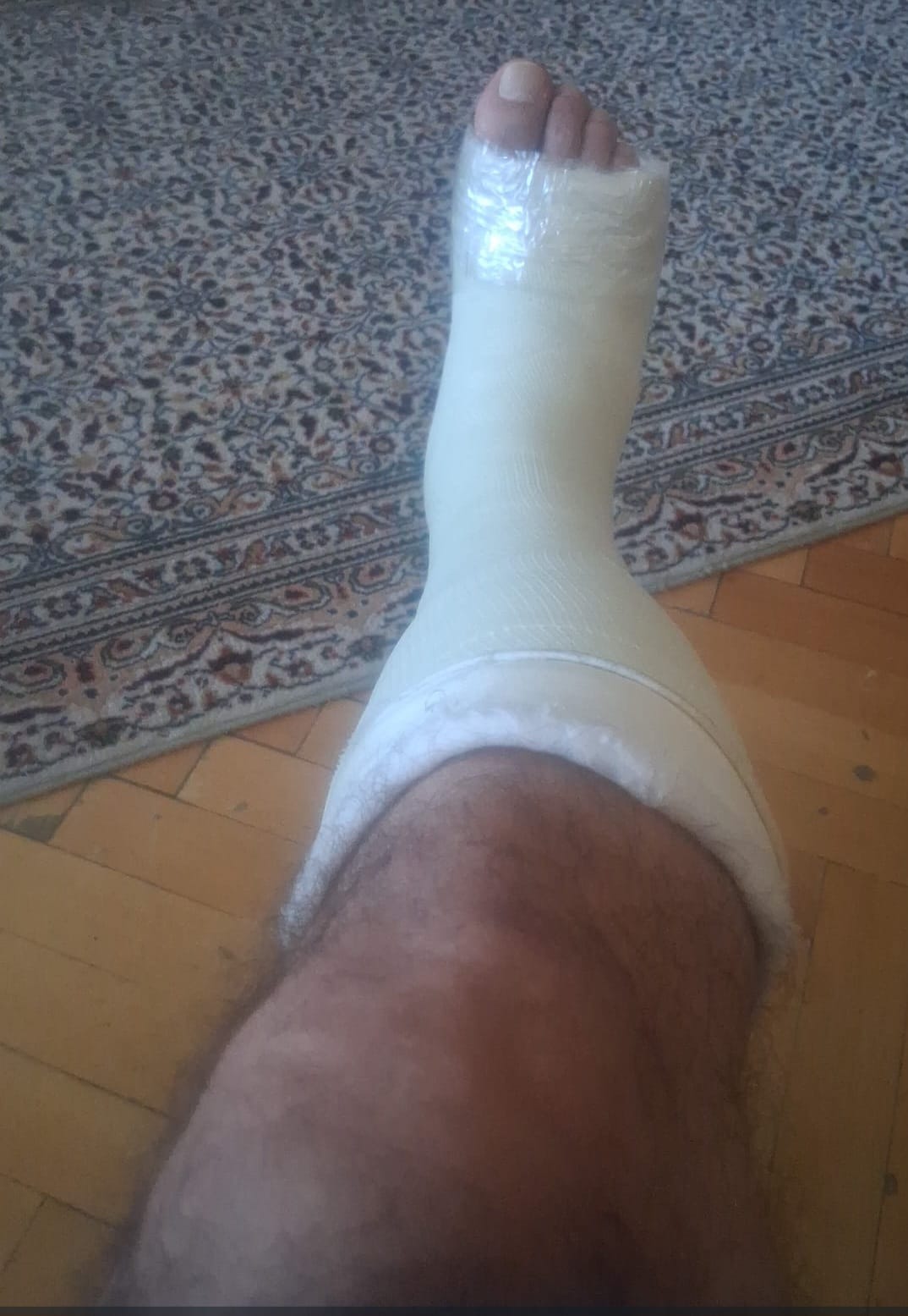 Elazığ Belediyesi’nin Bozuk Kaldırımı Kemik Çatlattı